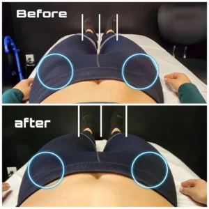 Anatomymechanicstherapy - Gallery Anatomy Mechanics Therapy (1)