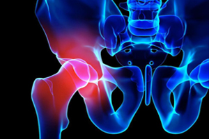 Herniated Disc -Licensed Massage Therapist