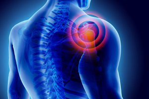 Shoulder Pain -Licensed Massage Therapist