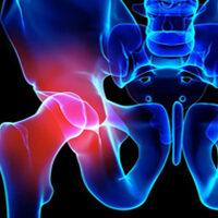 Herniated Disc -Licensed Massage Therapist