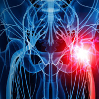 Sciatica -Licensed Massage Therapist